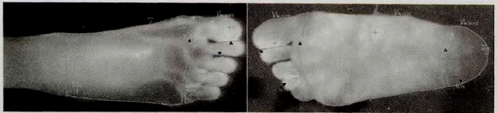 image032.gif